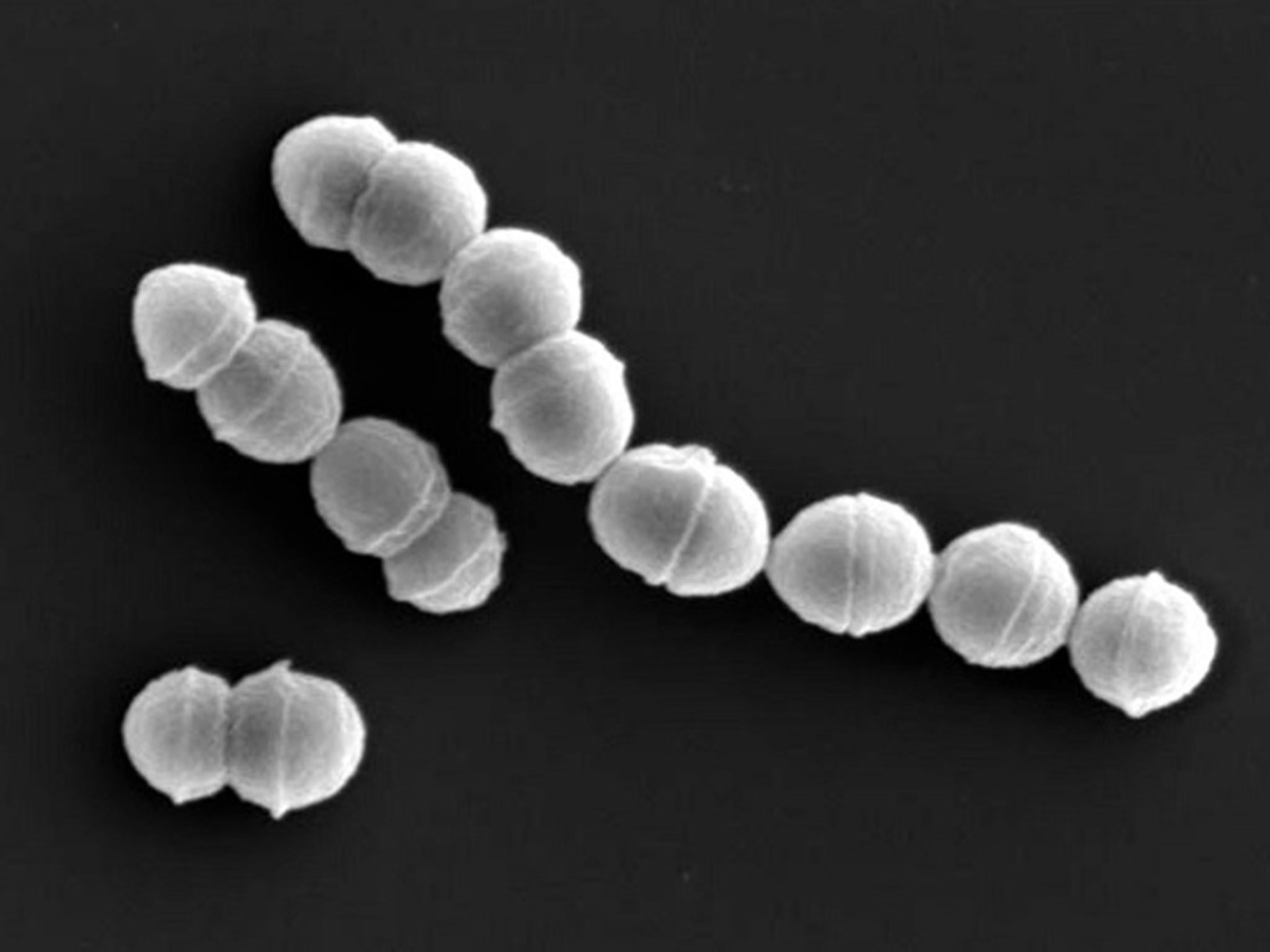 Over 1,000 cases of streptococcal toxic shock syndrome (STSS) were reported in Japan in the first six months of 2024. The disease is predominantly caused by a bacterium named Streptococcus pyogenes (pictured)