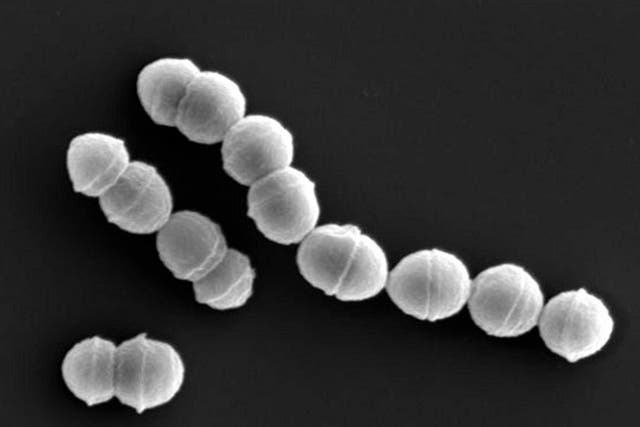 <p>Over 1,000 cases of streptococcal toxic shock syndrome (STSS) were reported in Japan in the first six months of 2024. The disease is predominantly caused by a bacterium named Streptococcus pyogenes (pictured) </p>