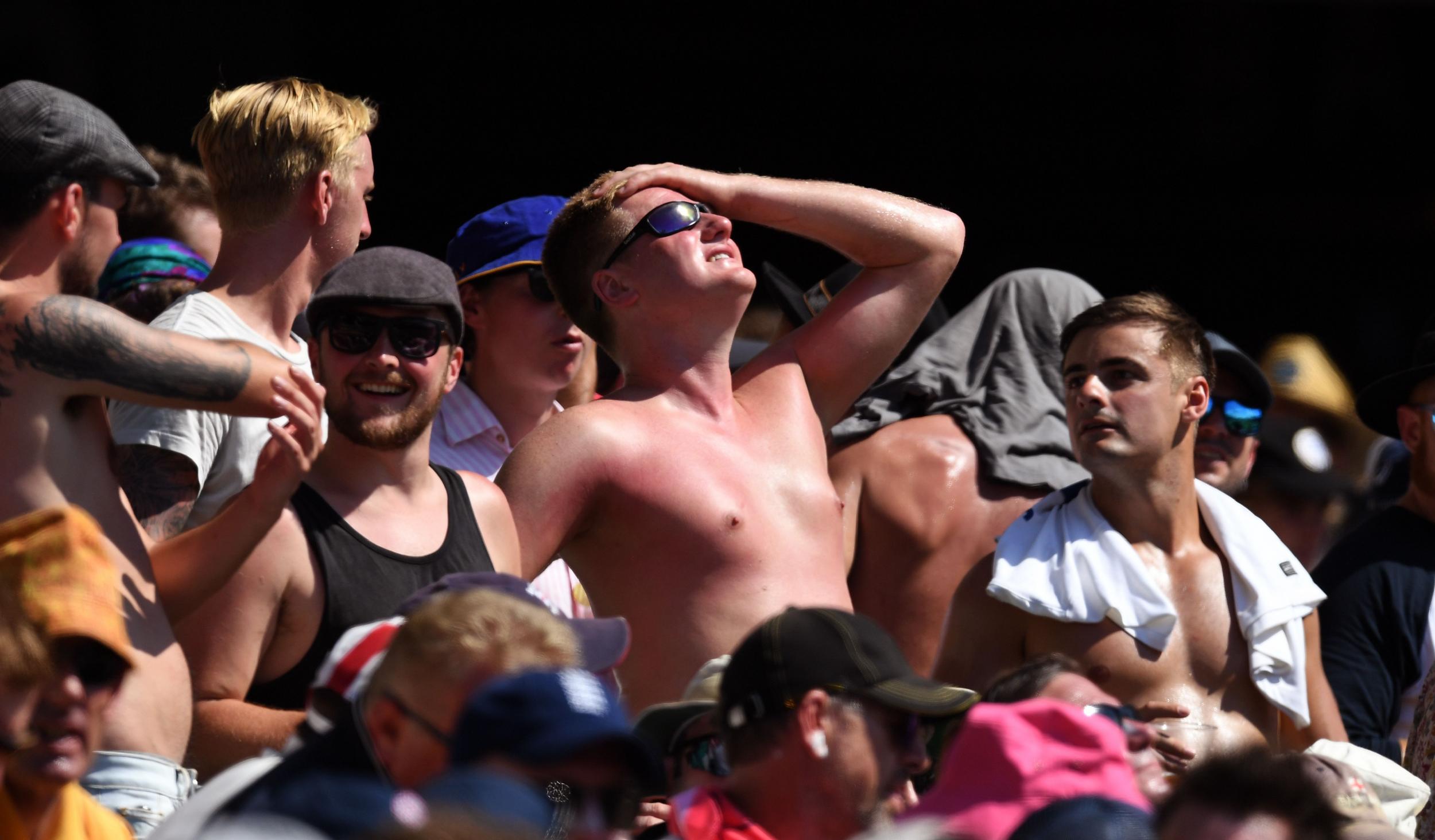 A sunburned English fan looks to the sun while watching the cricket on the fourth day of the fifth Ashes cricket Test match between Australia and England at the SCG in Sydney