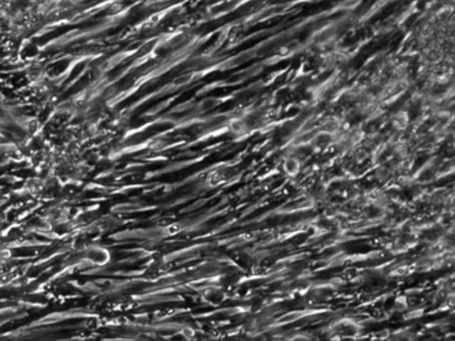 Duke engineers have grown the first functioning human muscle from non-muscle cells -- skin cells reverted to their primordial stem cell state. The advance holds promise for cellular therapies, drug discovery and studying rare diseases.