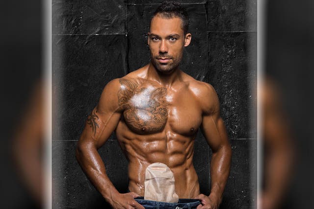 Model Blake Beckford told how he was humiliated when his colostomy bag leaked - and staff at a conference centre refused to let him use the toilet