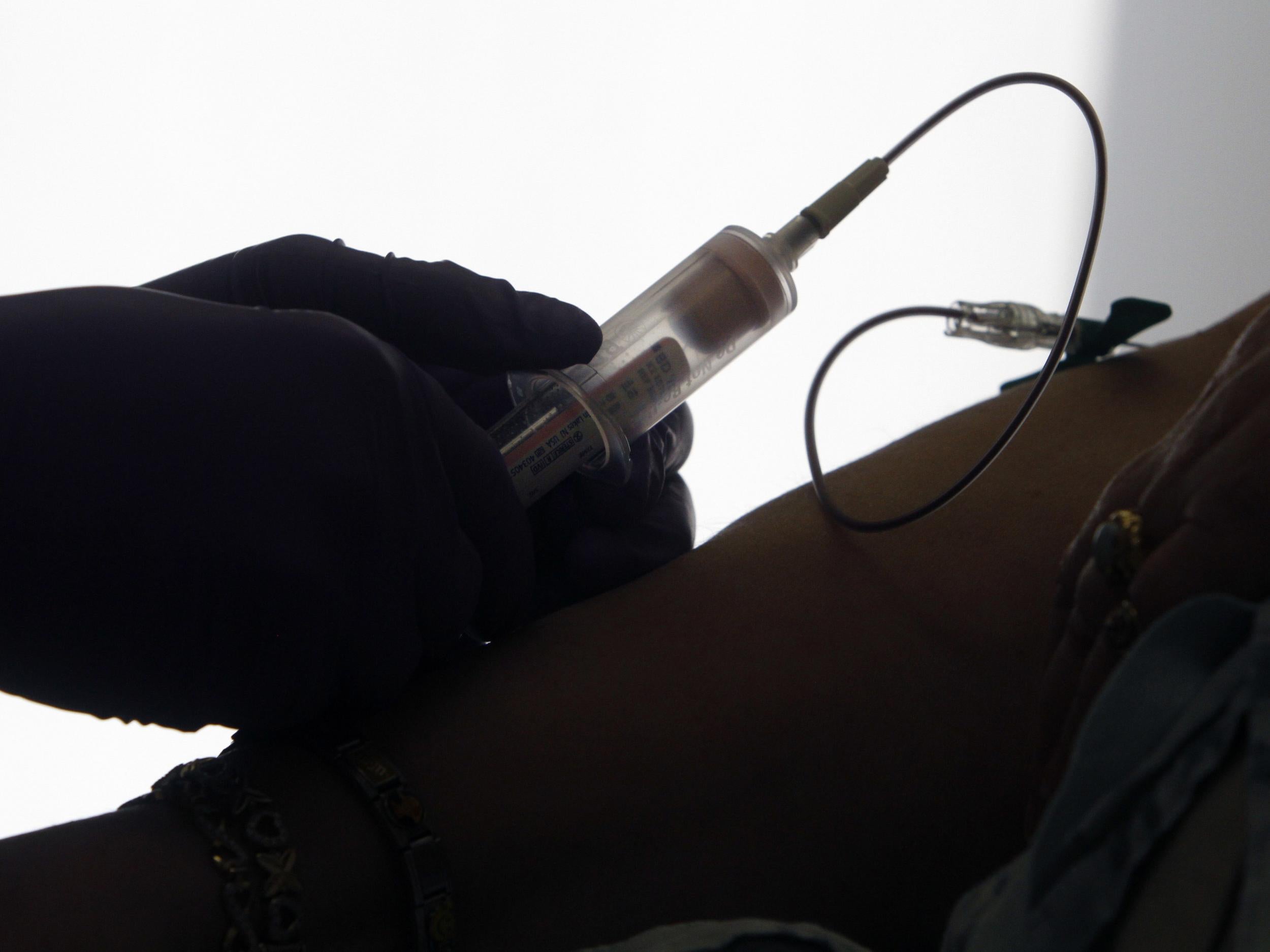 A patient has her blood drawn