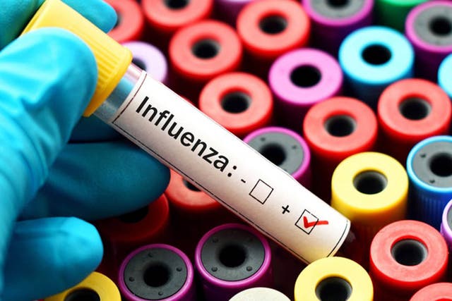 Seasonal influenza epidemics are usually caused by a mixed bag of viruses