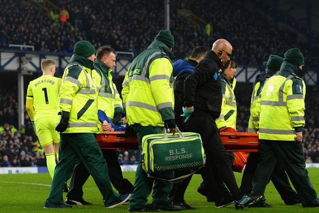 James McCarthy broke his leg against West Brom