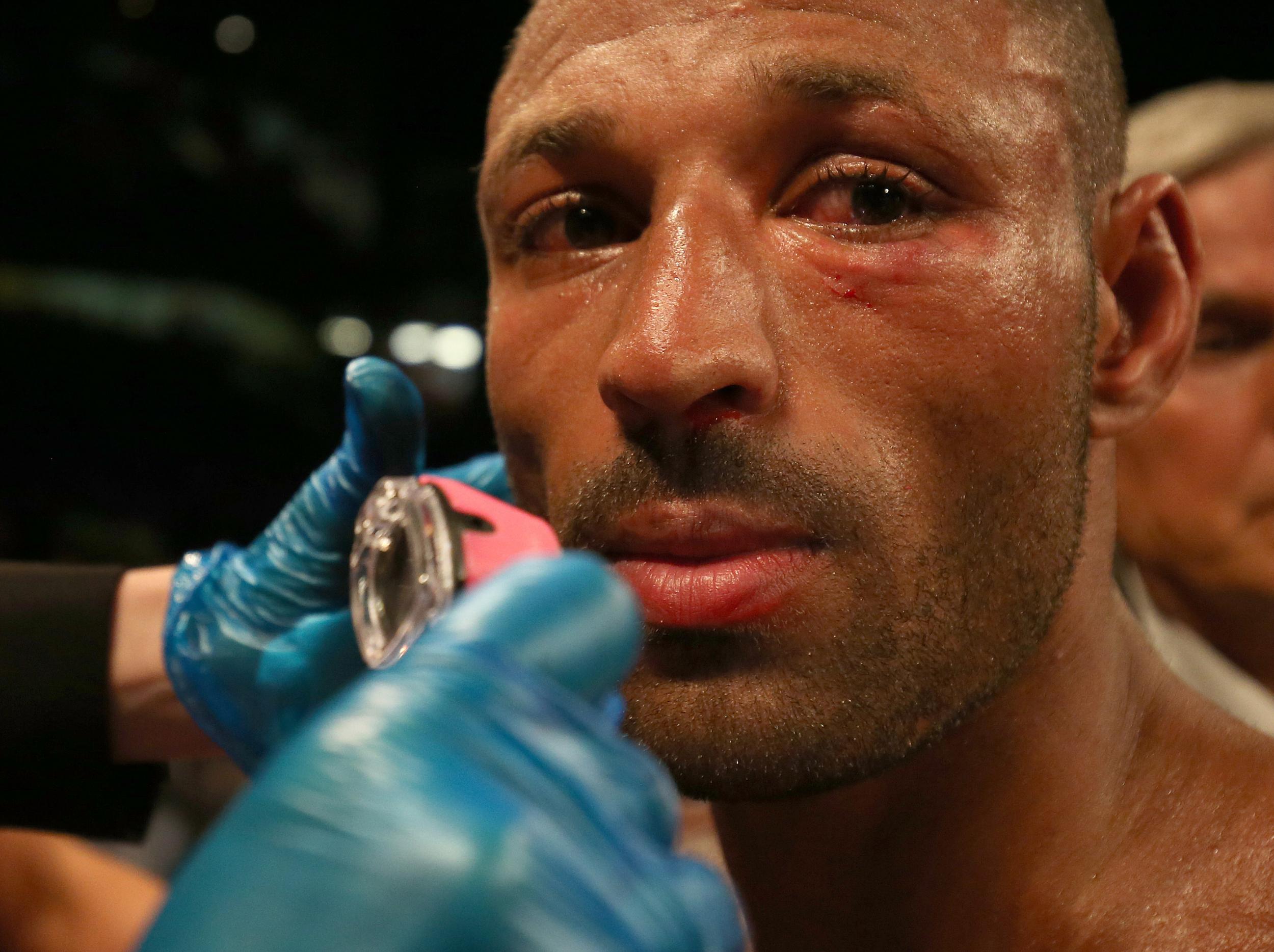 Brook is looking to bounce back from losing his welterweight strap