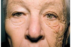 This photo shows what 28 years of sun damage does to your face