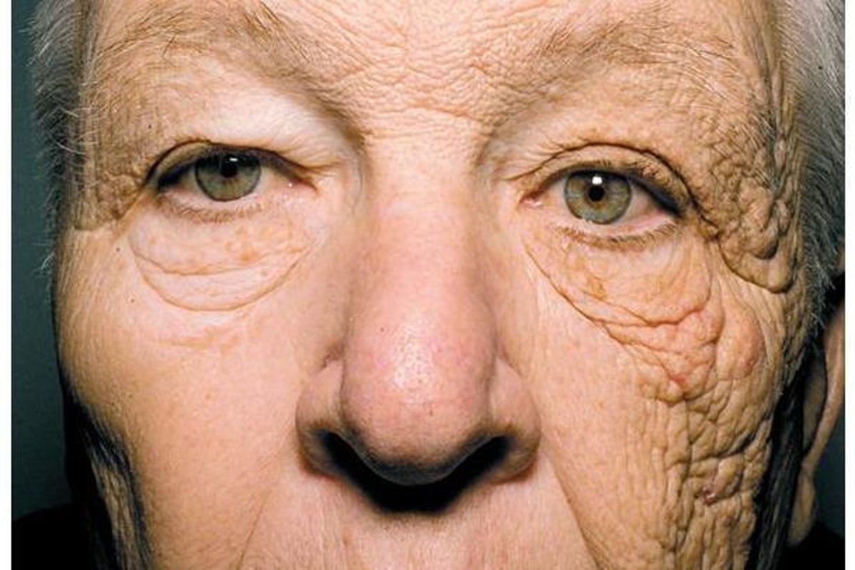 eenvoudig oor herhaling This photo shows what 28 years of sun damage does to your face | The  Independent | The Independent