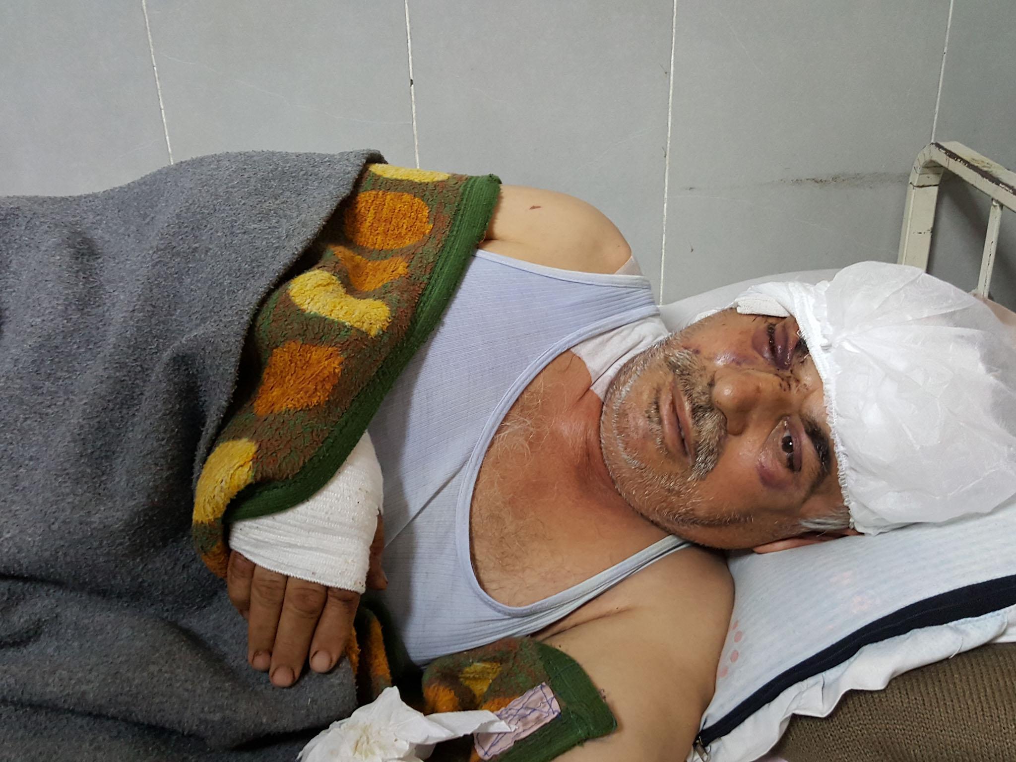 Mohamed Hussein, a 58-year-old Kurdish farmer, lies in the Afrin hospital, wounded in the head and eye after his home was bombed by a Turkish aircraft on the second night of the attack