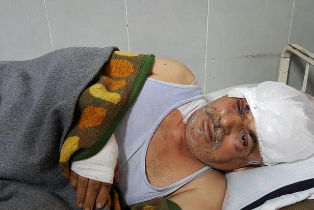 Mohamed Hussein, a 58-year-old Kurdish farmer, lies in the Afrin hospital, wounded in the head and eye after his home was bombed by a Turkish aircraft on the second night of the attack
