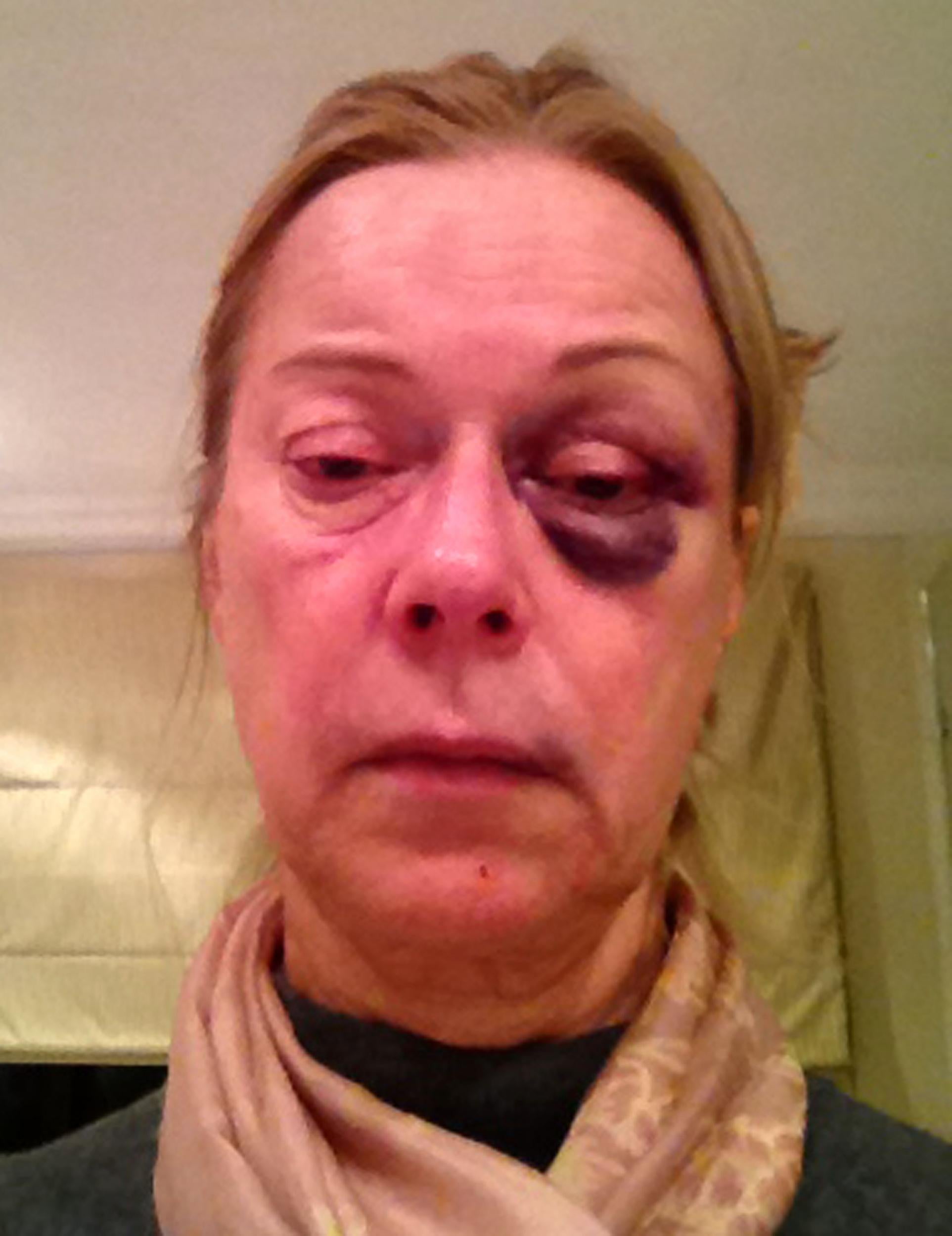 Susan Morris was tied up and repeatedly punched by the burglar