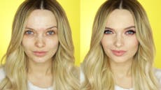 Skin positivity: The latest trend taking the beauty world by storm