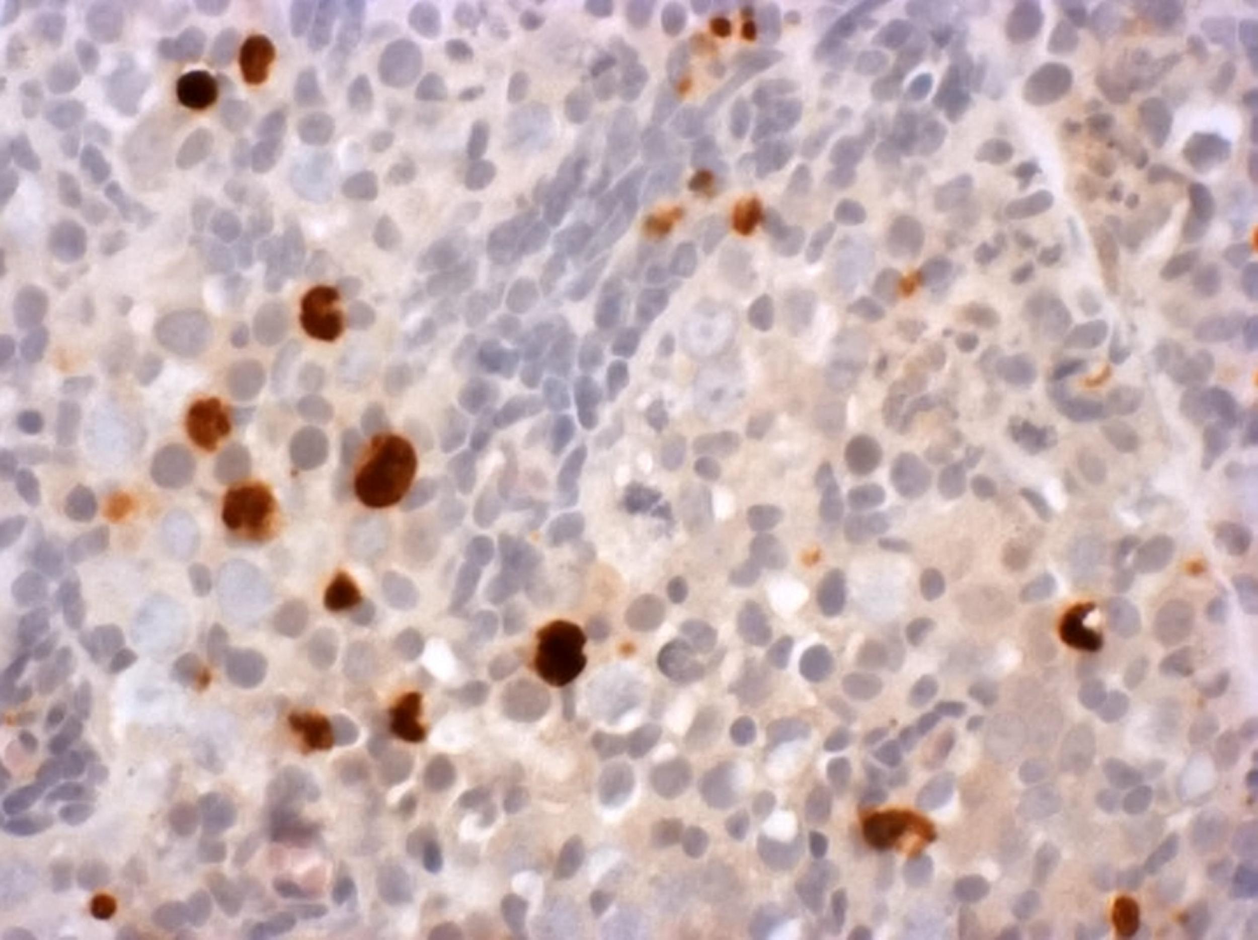 Dying brown germ cells are seen in ovarian tissue that has been exposed to ibuprofen for seven days ( INSERM / SWNS.com)