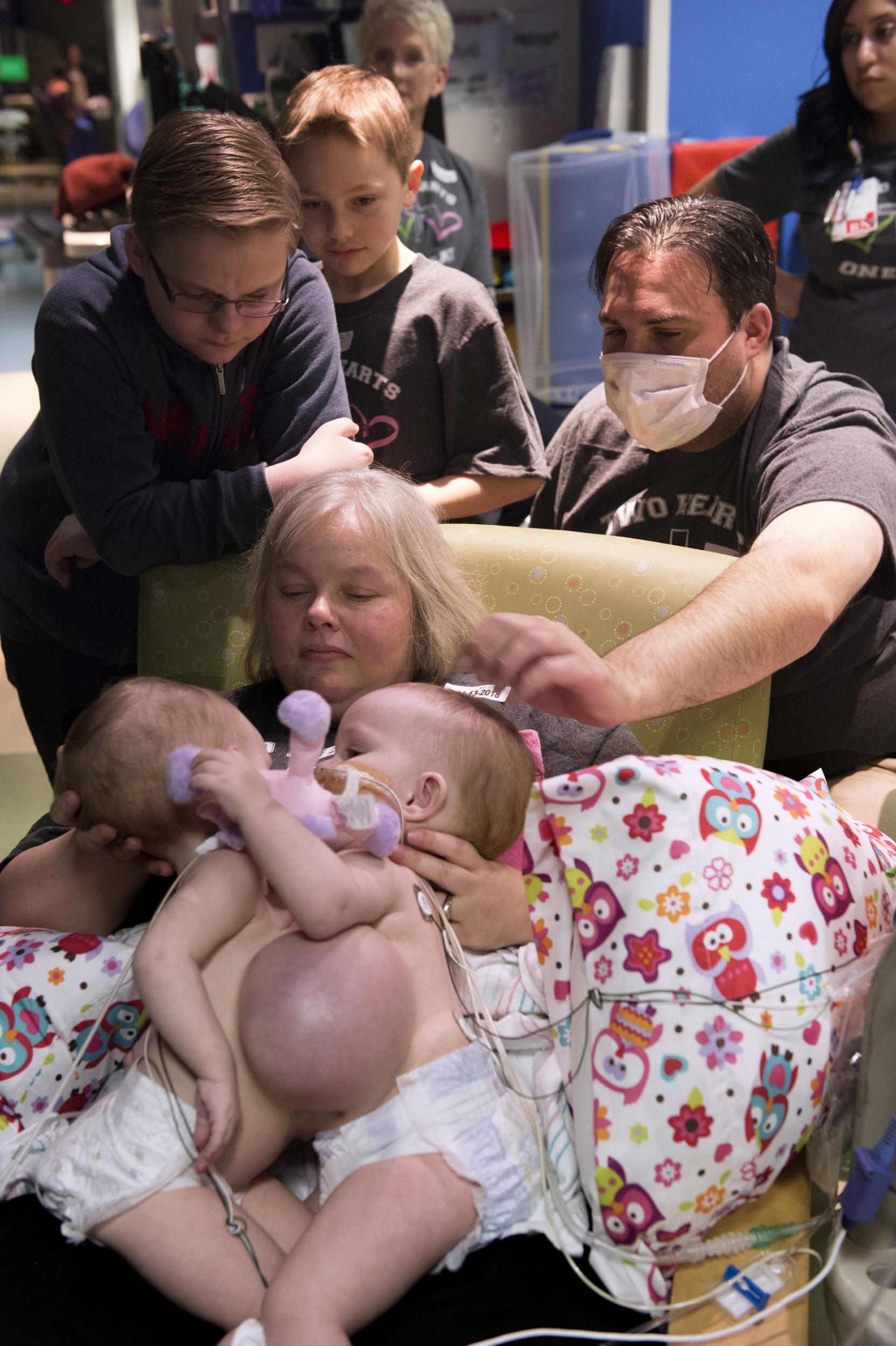 Anna and Hope with their mum Jill before surgery (Paul Vincent Kuntz/Texas Children's Hospital)