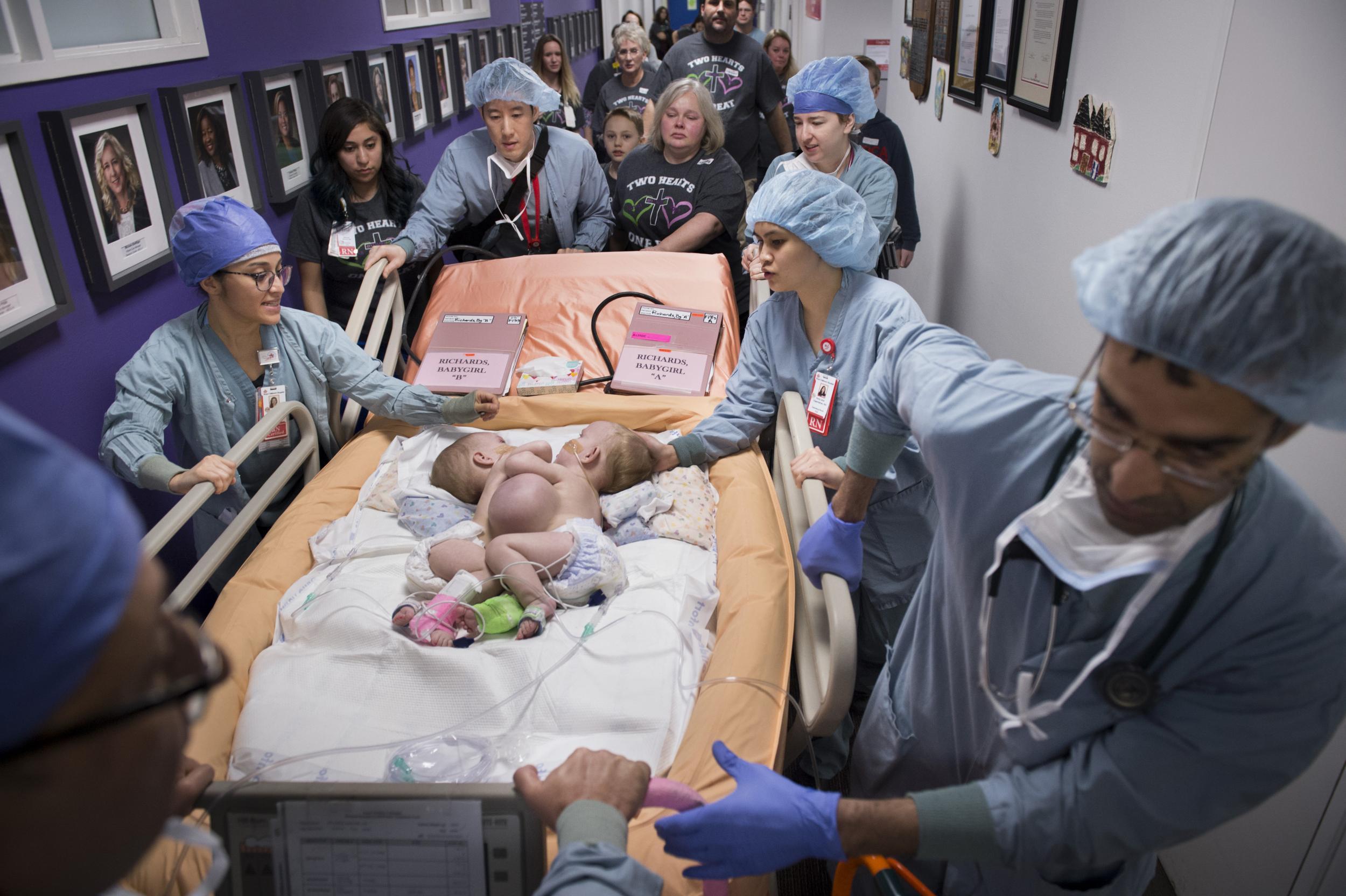 The babies are brought into surgery to detach their chest wall (Paul Vincent Kuntz/Texas Children's Hospital)