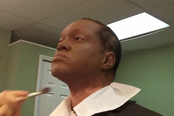 Lee Thomas uses makeup to cover his neck and face