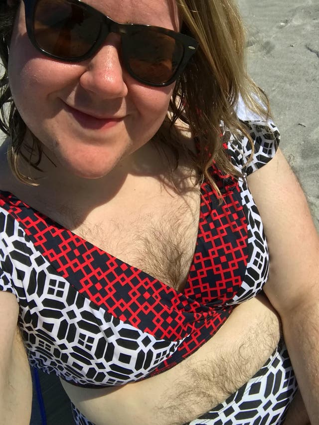 Woman champions body positivity by embracing thick body hair caused by  hormonal disorder | The Independent | The Independent