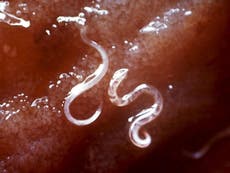 Parasitic worm study axed after couple’s buttocks end up in tabloids