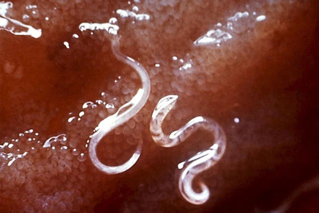 The pair believe they contracted the hookworm larvae parasite while sitting on a beach