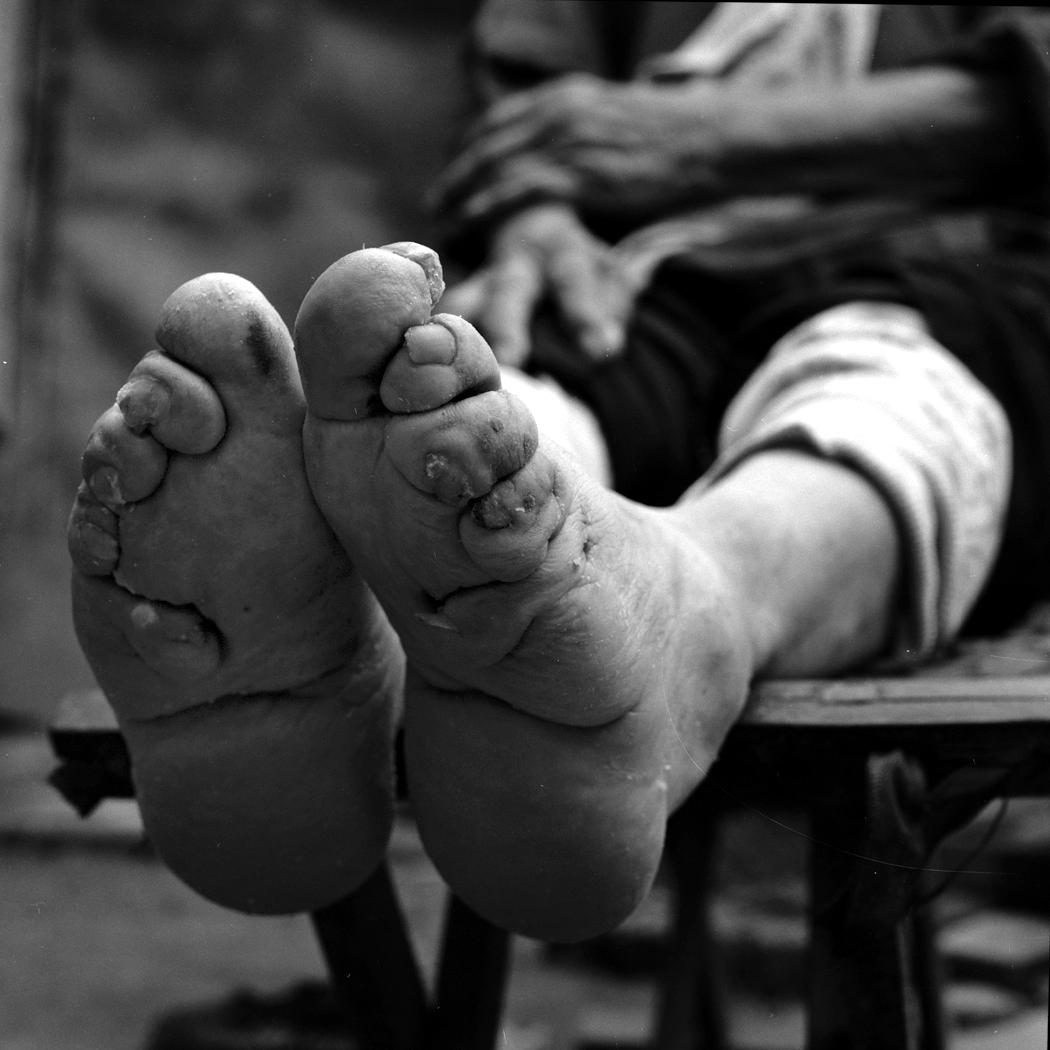 These Graphic Images Show The Last Surviving Women In China With Bound Feet Indy100 Indy100