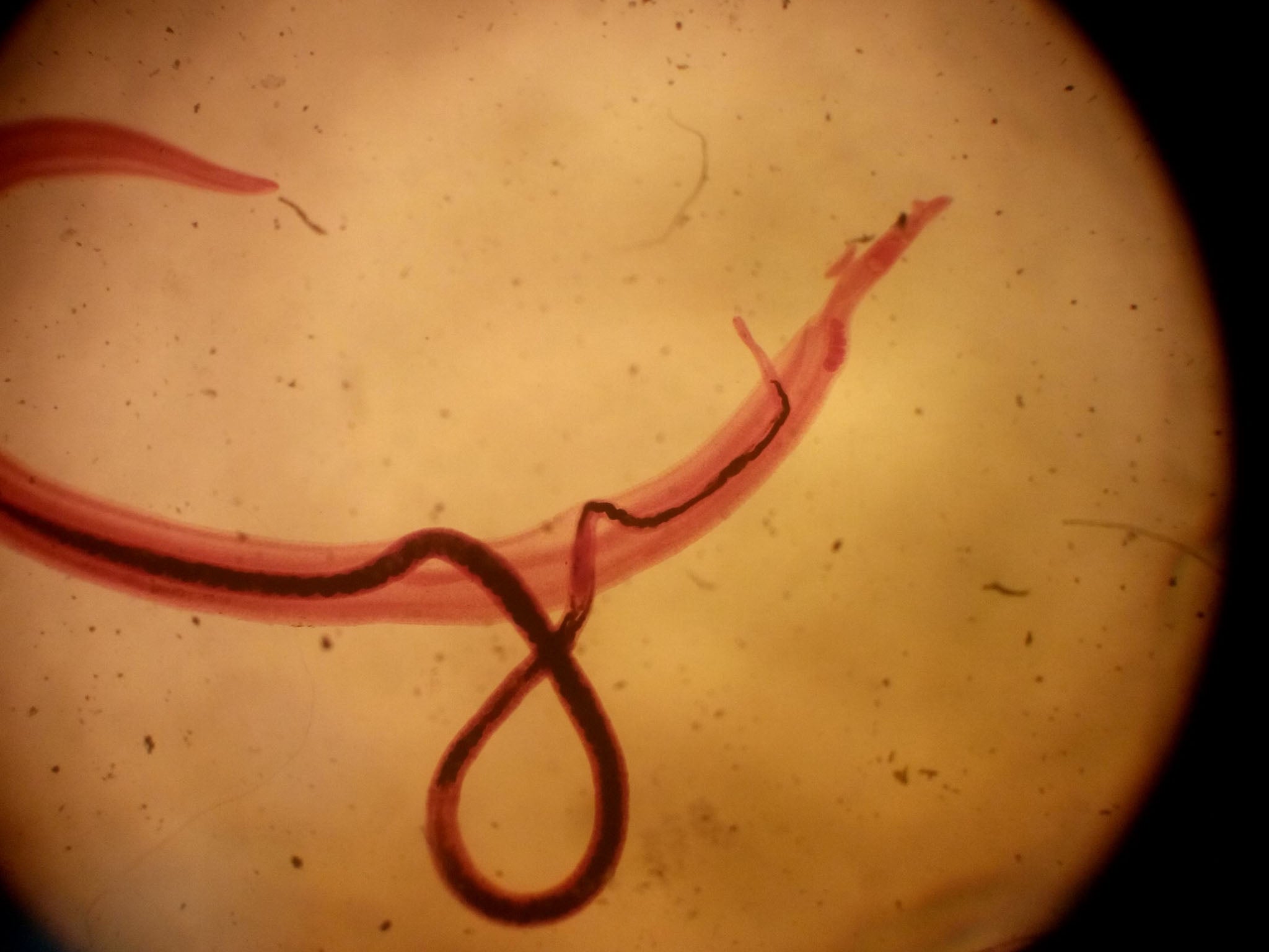 A pair of schistosoma mansoni parasites