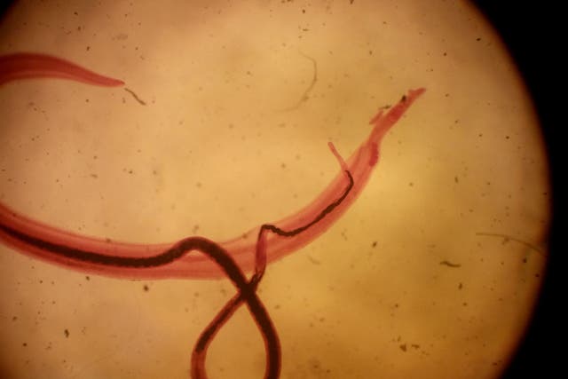 A pair of schistosoma mansoni parasites