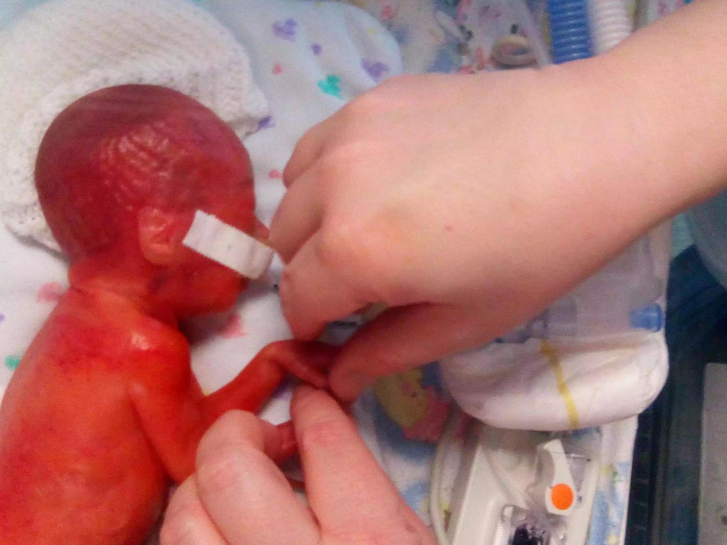 premature baby birth