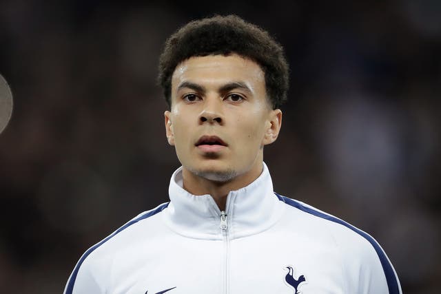 Is Dele Alli one of the best players in the world?