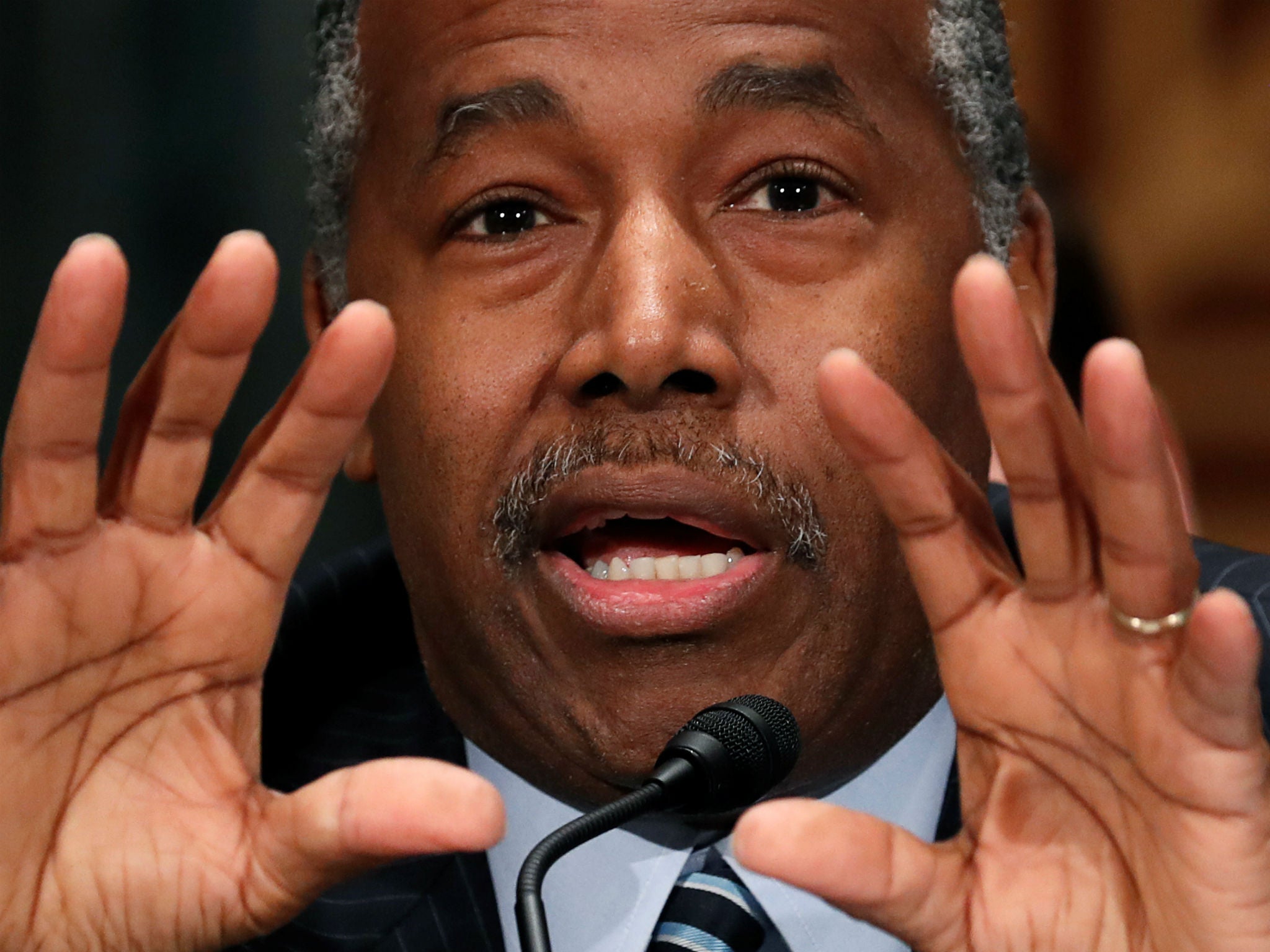 Ben Carson says conditions at the border are &apos;quite nice&apos;
