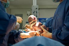 Why hospitals should never turn down elective Caesareans