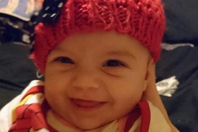 Five-month-old Hayley Davidson suffered a bleed on her brain and multiple fractures