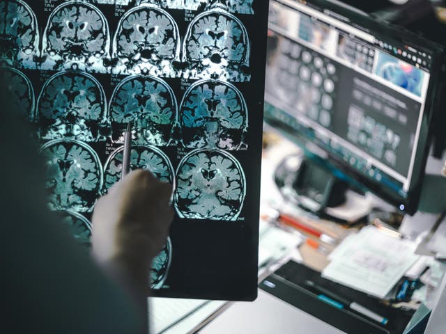 <p>Research has been conducted to see which brain cells are behind intelligent behaviour</p>