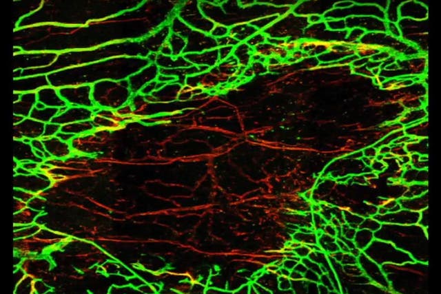 US team found that a second concussion in 24-hour period prevented normal regeneration of damaged blood vessels
