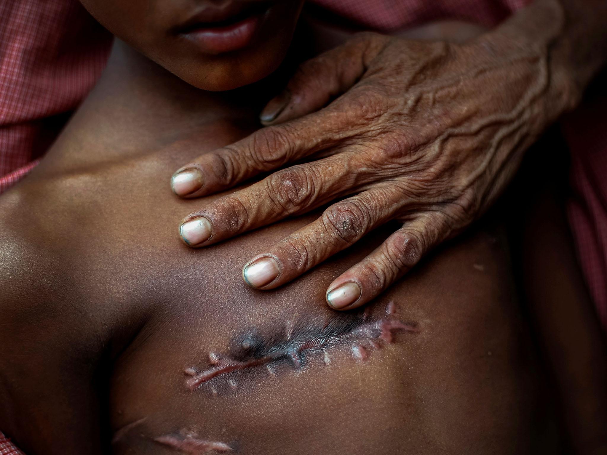 Mohammed Shoaib, 7, was shot in his chest before crossing the border from Myanmar (Reuters)