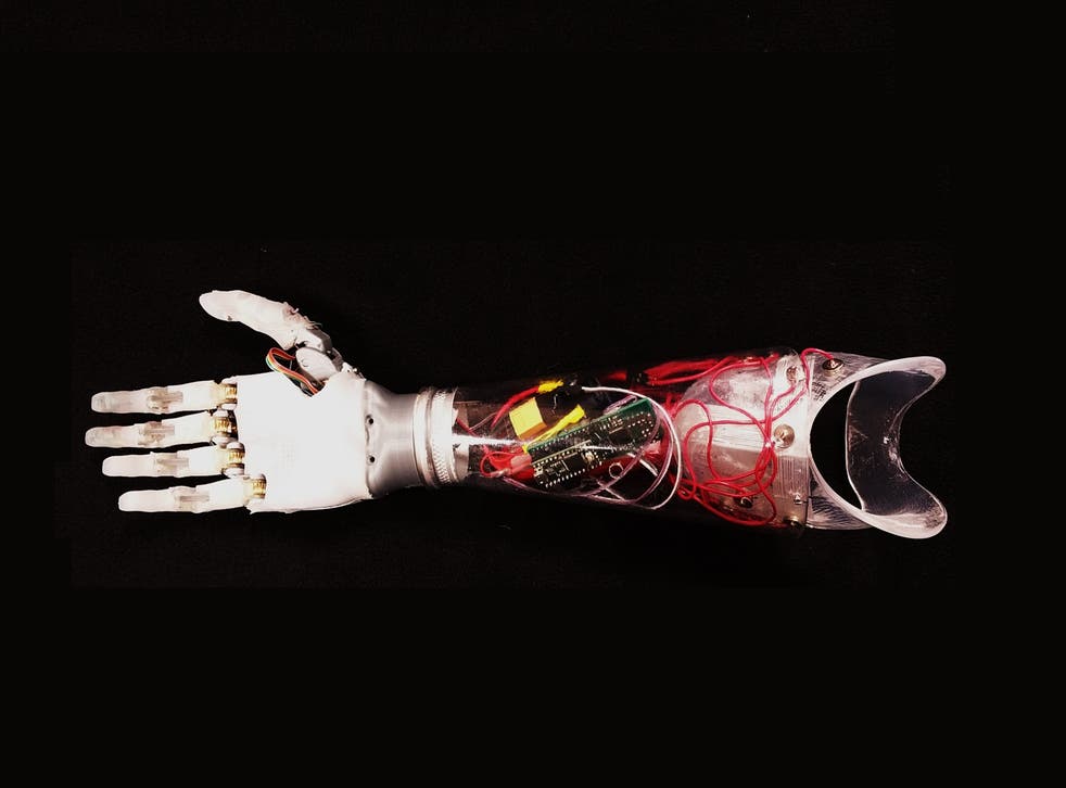 Researchers from the University of Illinois hope to embed the algorithm in existing prosthetics, such as Psyonic's bionic arm