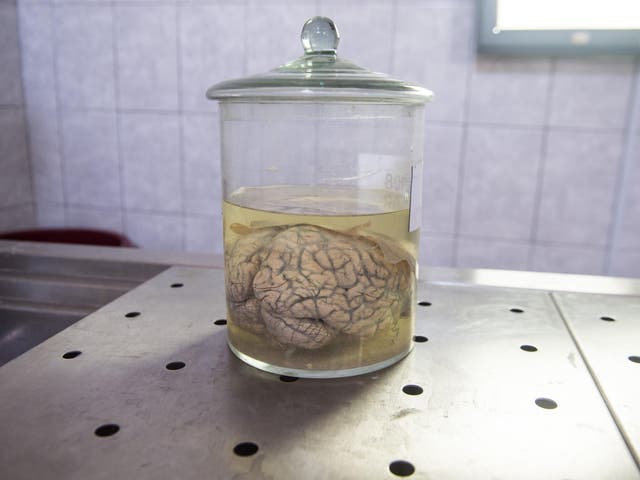 A human brain preserved in formaldehyde: the scientists behind a new experiment have expressed concerns about its future application in humans