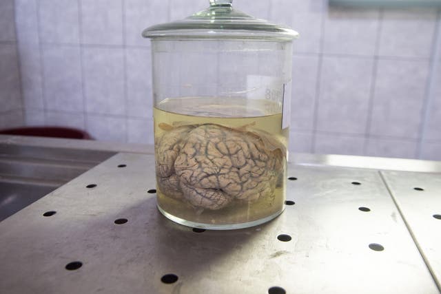 A human brain preserved in formaldehyde: the scientists behind a new experiment have expressed concerns about its future application in humans