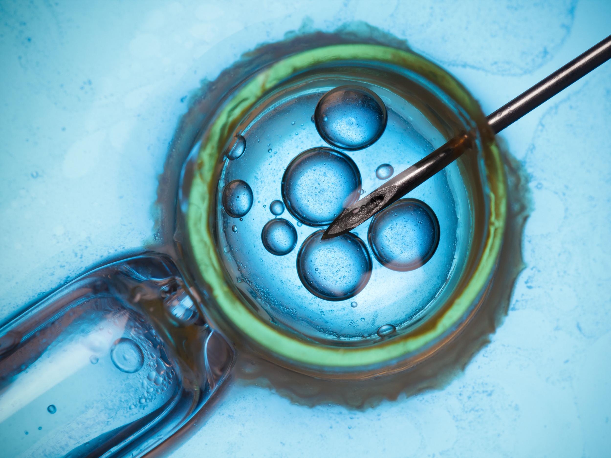 Six out of 10 IVF cycles in the UK are funded by patients themselves, according to the the Royal College of Obstetricians and Gynaecologists