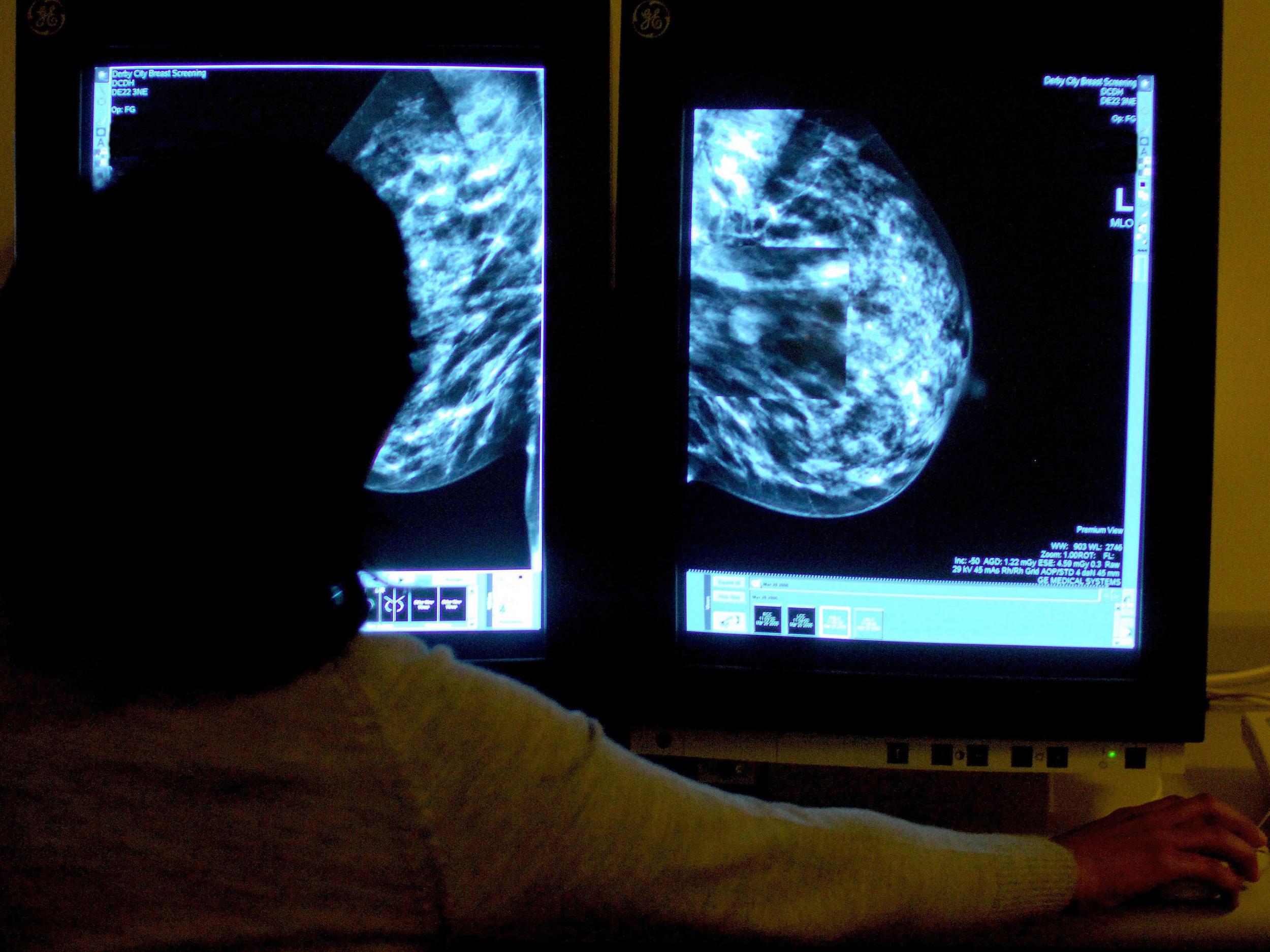 The charity calls for women to examine their breasts for breast cancer at least every six weeks