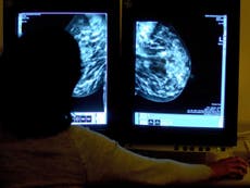 Almost half of women do not regularly check for signs of breast cancer