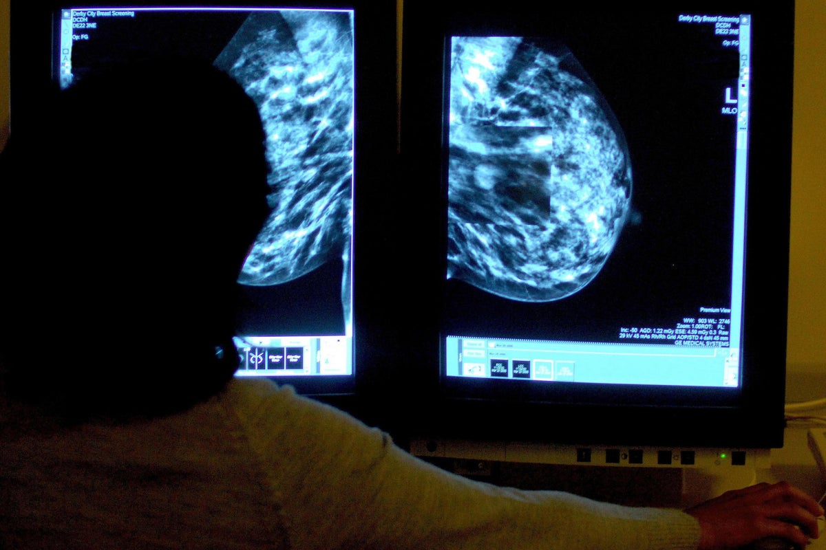 Breast cancer survey finds almost half of women do not regularly examine themselves