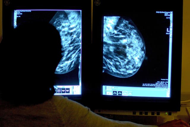 The charity calls for women to examine their breasts for breast cancer at least every six weeks