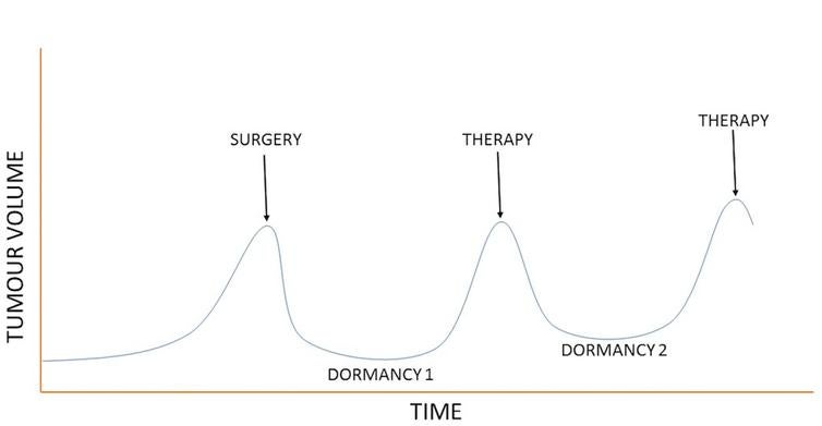 Figure 1. An example of prostate cancer progression