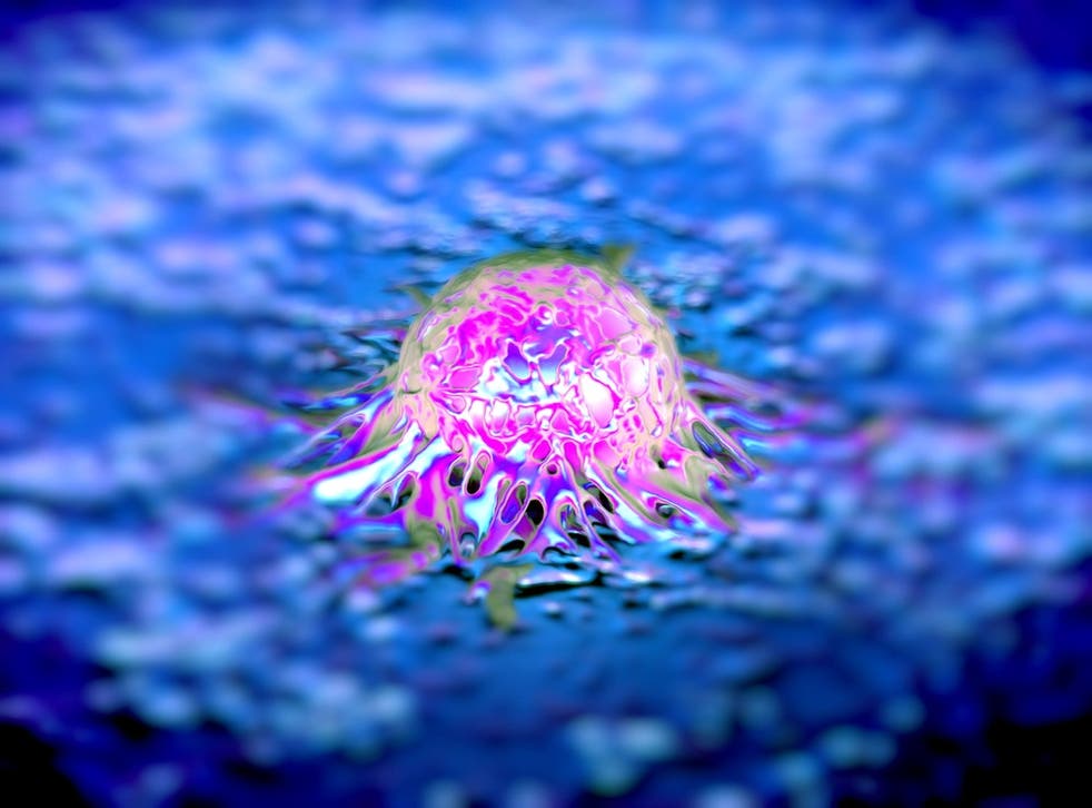 A prostate cancer cell, viewed with a scanning electron microscope