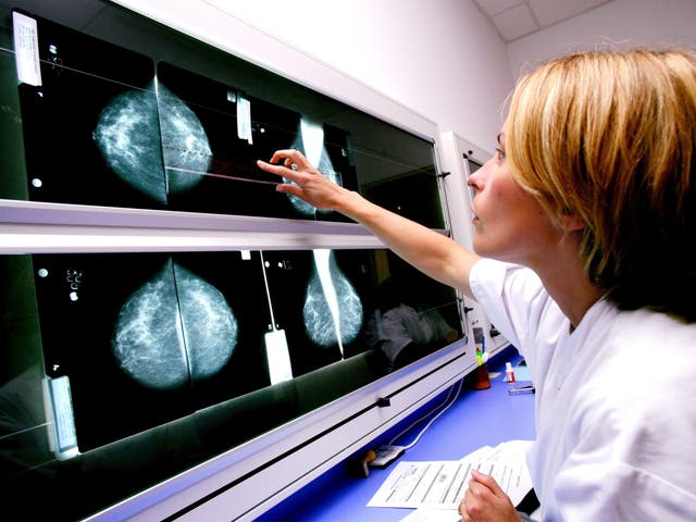A radiologist examines mammograms on a lightbox