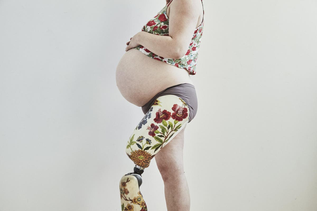 Pregnant amputee does maternity photoshoot to empower women with  disabilities | The Independent | The Independent