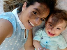 Mother gets birthmark painted on face in tribute to baby son