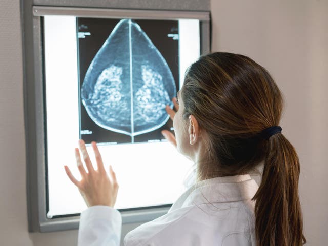 Before and after MRI scans show the effect immunotherapy has on breast cancer patient
