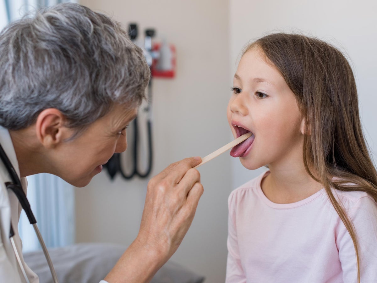 Healthy Tonsils Vs Unhealthy Tonsillitis Causes Symptoms Treatment