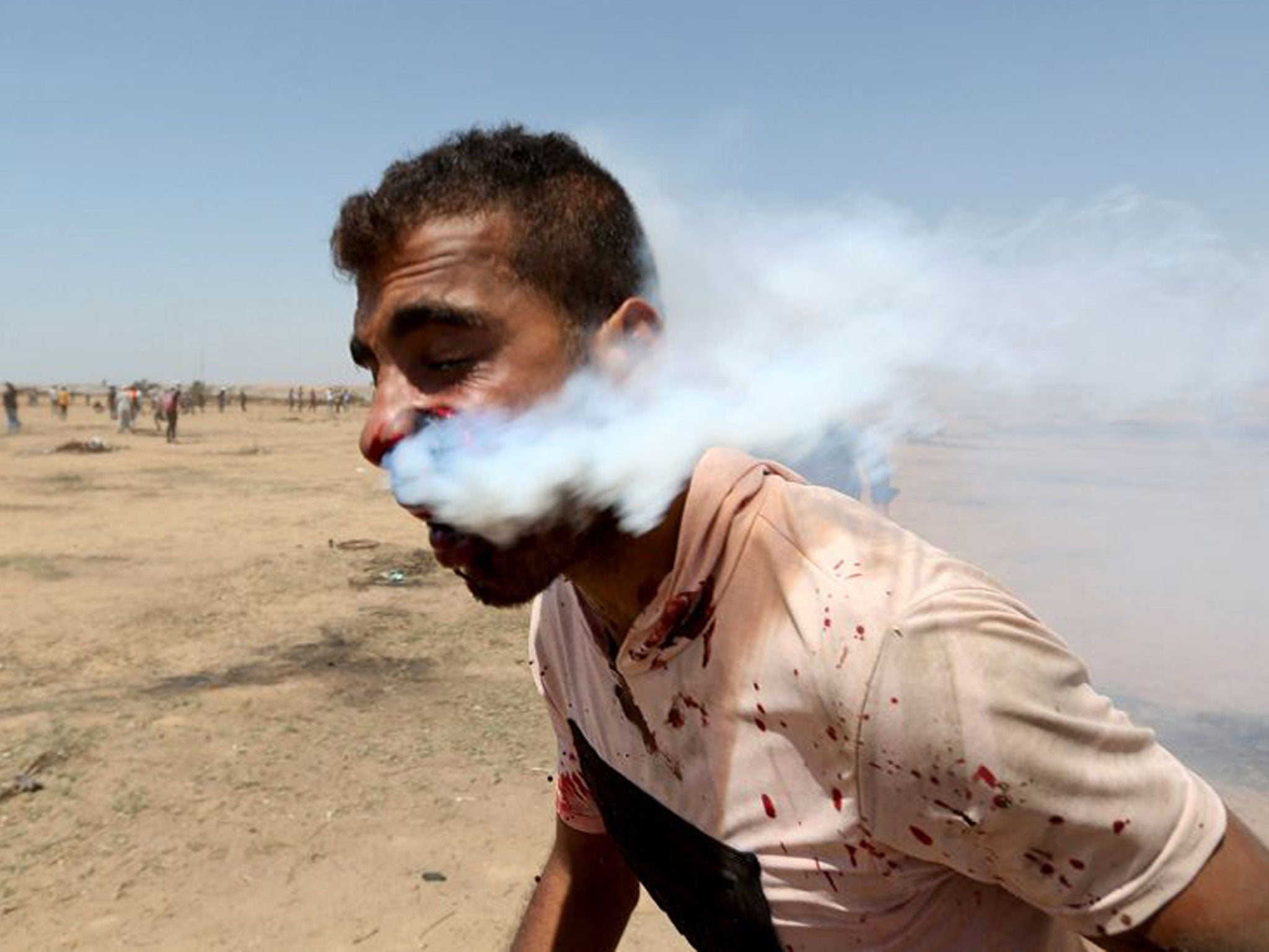 A wounded Palestinian demonstrator, Haitham Abu Sabla, 23, is hit in the face with a tear gas canister fired by Israeli troops