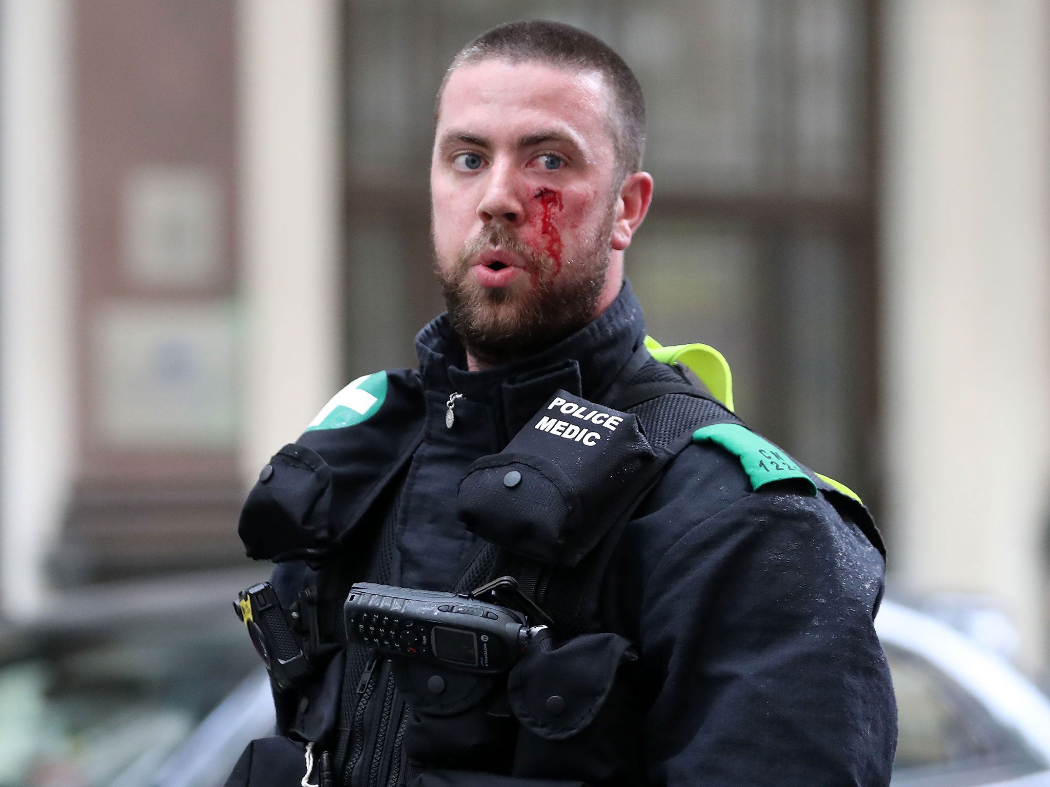 An injured police officer during a ‘Free Tommy Robinson’ protest in London on 9 June